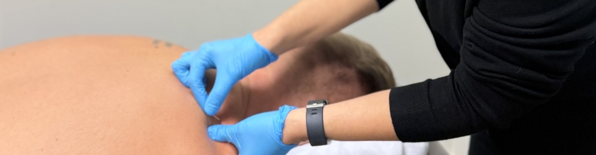 dry-needling-Montrose-Physiotherapy-and-Massage-Abbotsford-BC-1920x500-clinic-pic