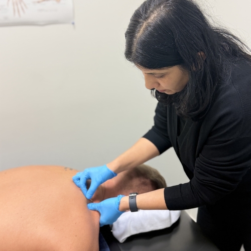 dry-needling-Montrose-Physiotherapy-and-Massage-Abbotsford-BC-clinic-pic